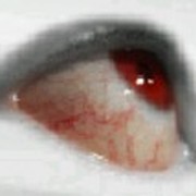 Red Eyer on My World.